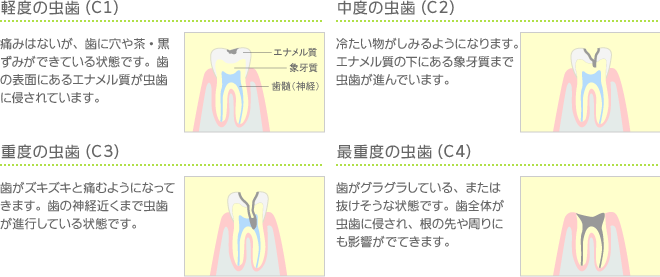 虫歯のセルフチェック