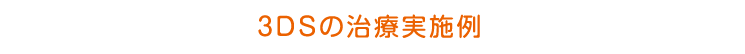 3DSの治療実施例