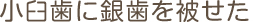 小臼歯に銀歯を被せた