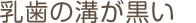 乳歯の溝が黒い