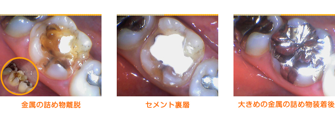 5月の症例2