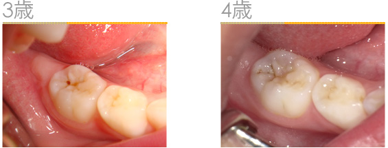 2015年6月の症例_3歳、4歳