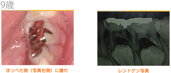 9歳