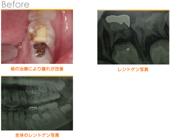 2015年6月の症例_術前