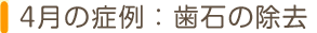 4月の症例：歯石の除去